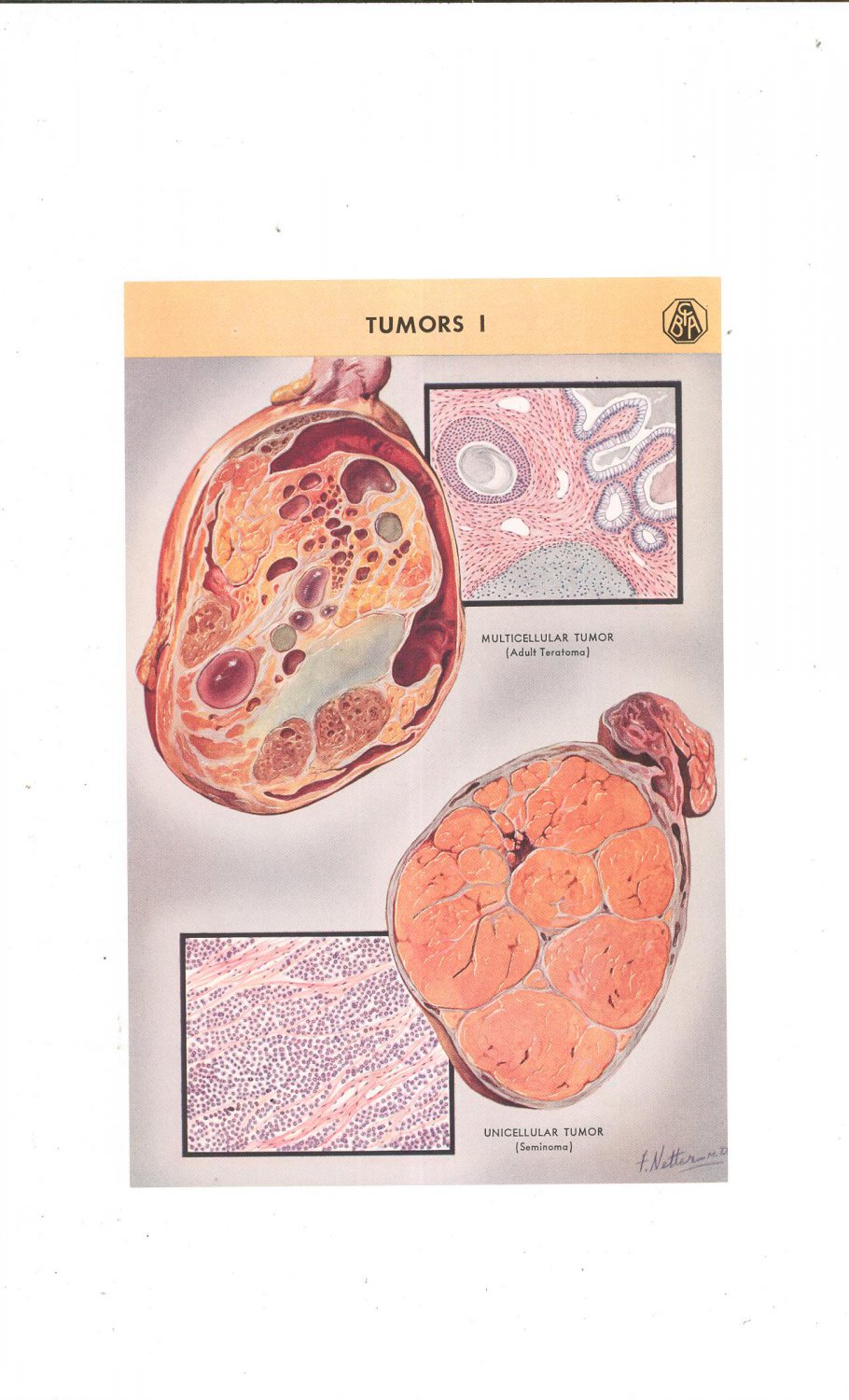 Vintage Lot of 2 Color Plates Major Anatomy And Pathology Of The Testicle Frank Netter Ciba