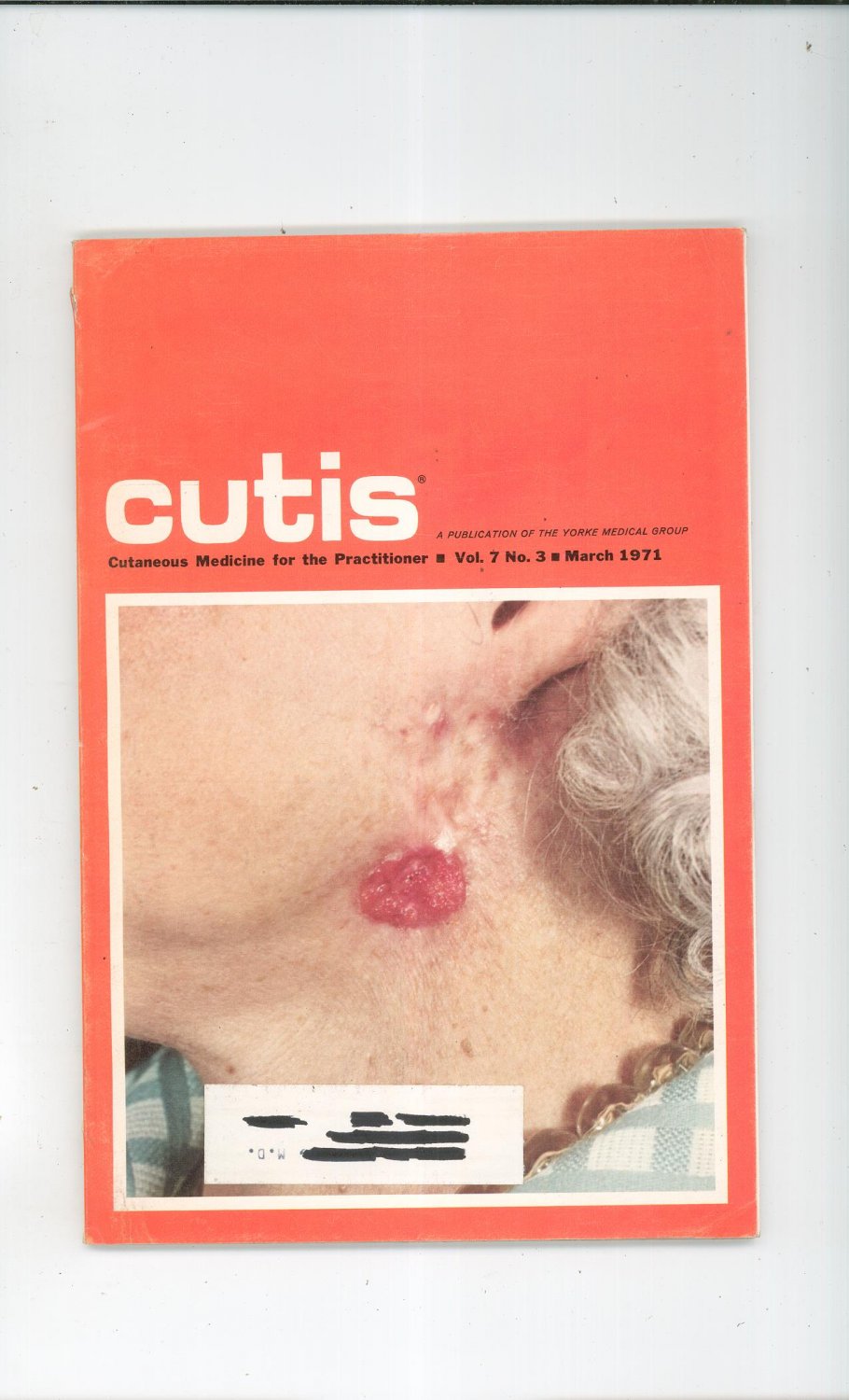 March 1971 Cutis Cutaneous Medicine For The Practitioner Magazine Vintage