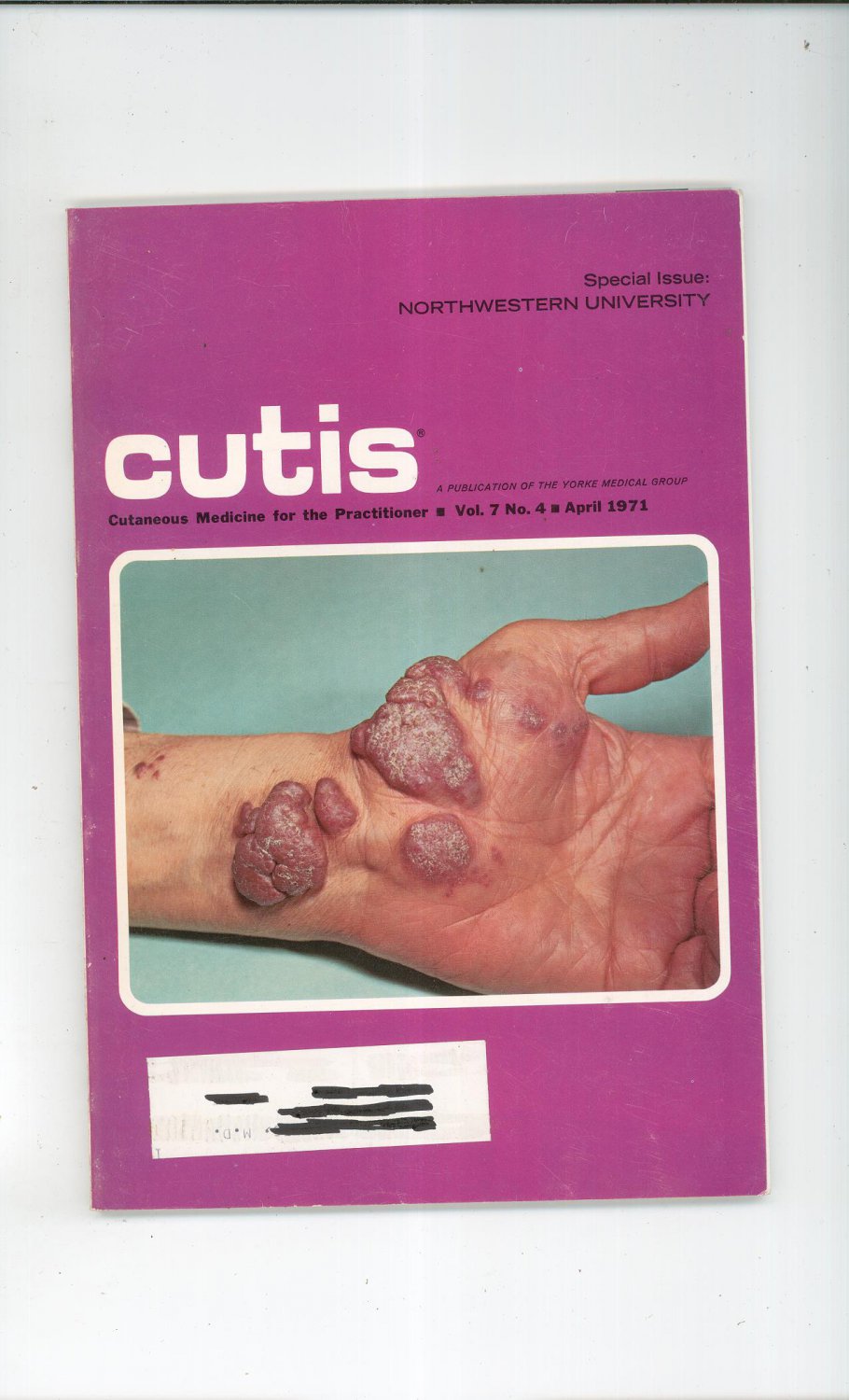 April 1971 Cutis Cutaneous Medicine For The Practitioner Magazine Vintage Northwestern University