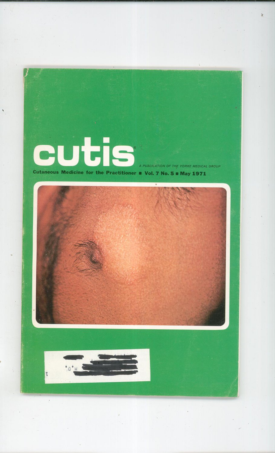 May 1971 Cutis Cutaneous Medicine For The Practitioner Magazine Vintage