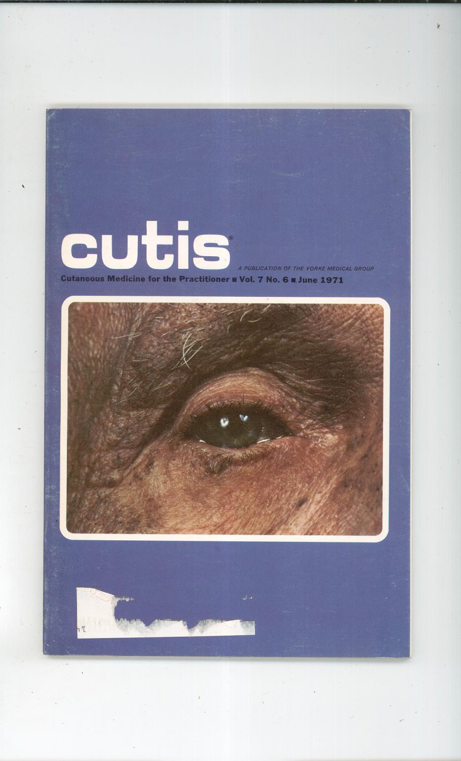 June 1971 Cutis Cutaneous Medicine For The Practitioner Magazine Vintage
