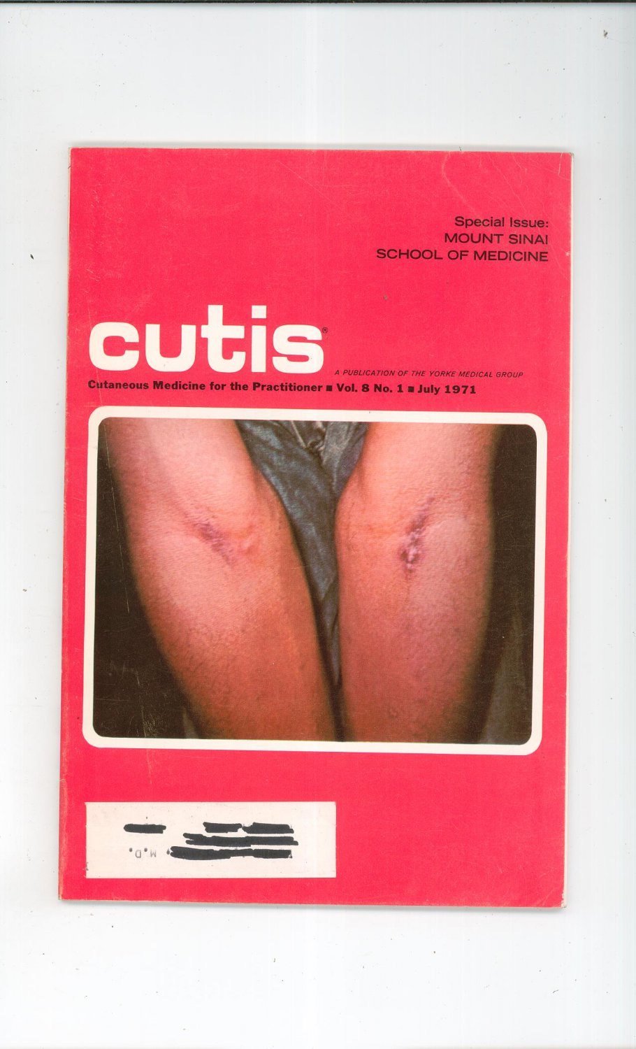 July 1971 Cutis Cutaneous Medicine For The Practitioner Magazine Vintage Mount Sinai School Medicine