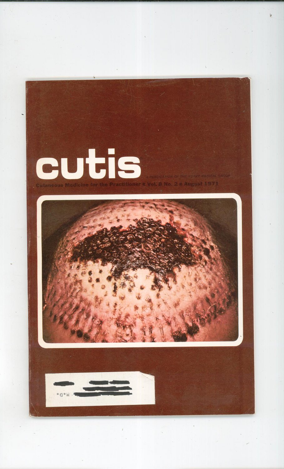 August 1971 Cutis Cutaneous Medicine For The Practitioner Magazine Vintage