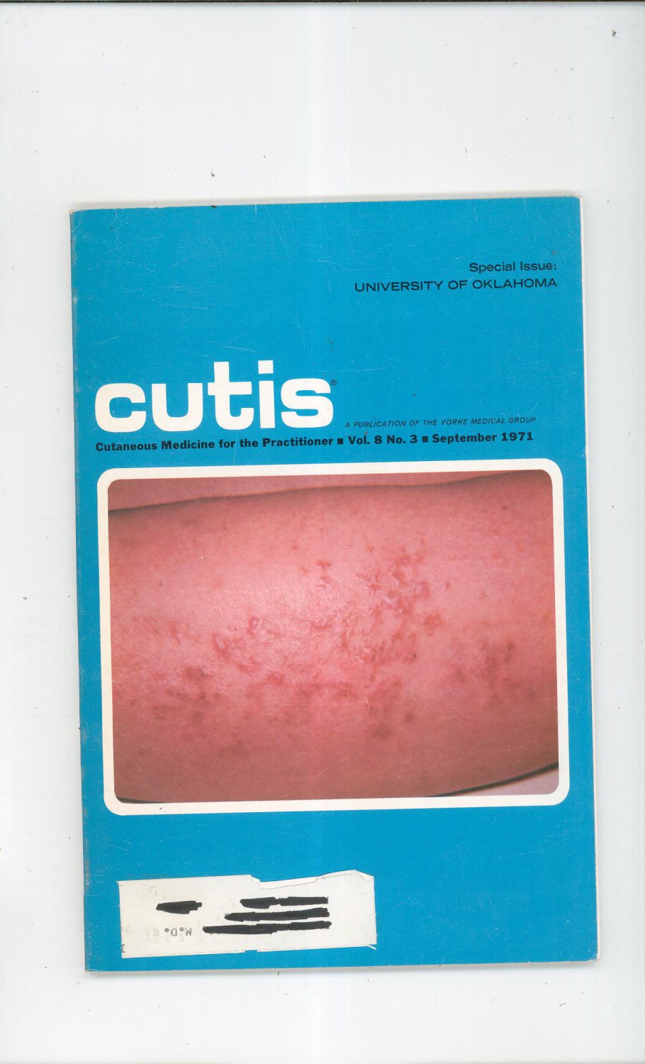 September 1971 Cutis Cutaneous Medicine For The Practitioner Magazine Vintage University Of Oklahoma