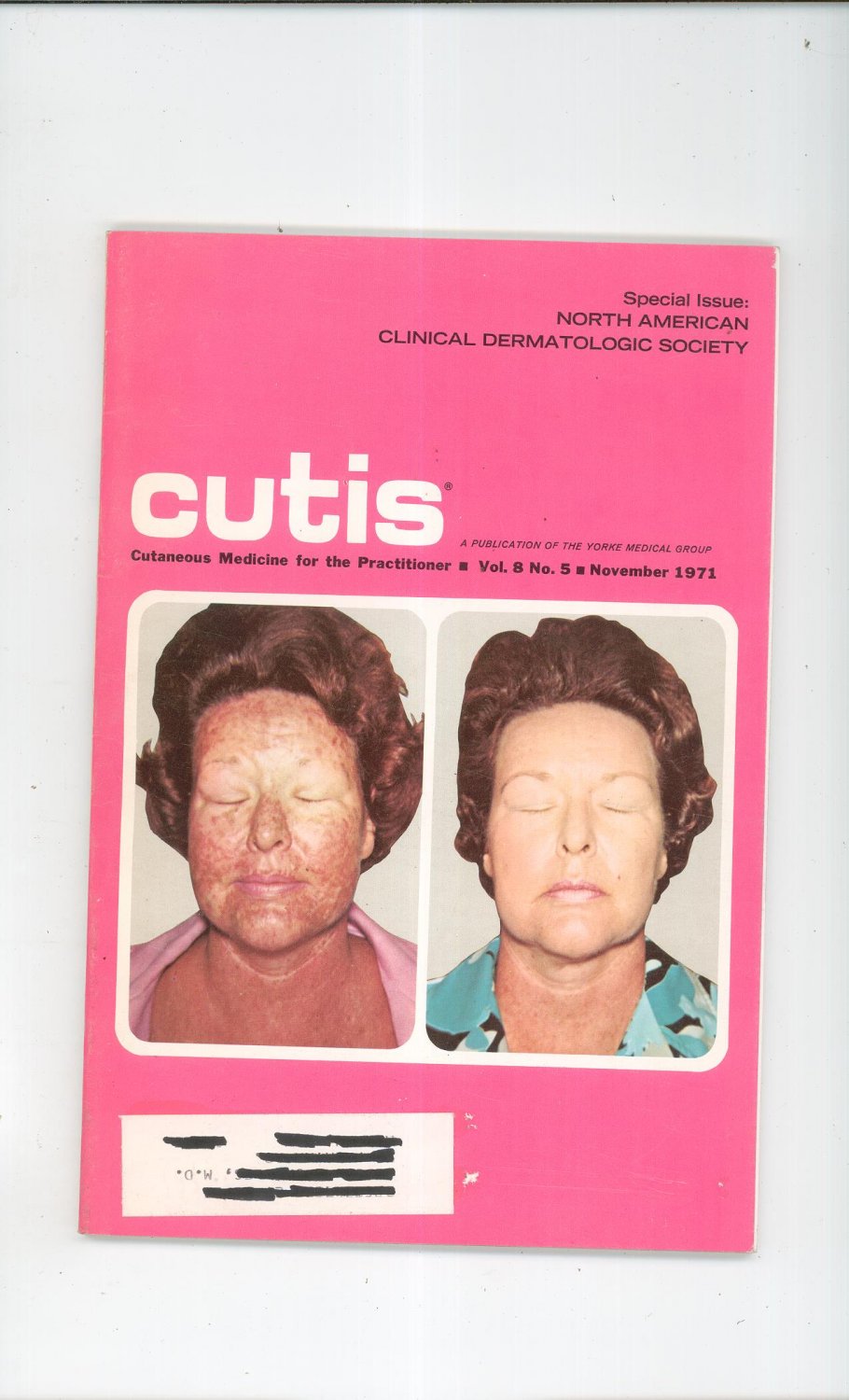 November 1971 Cutis Cutaneous Medicine For The Practitioner Magazine Vintage Dermatologic Society