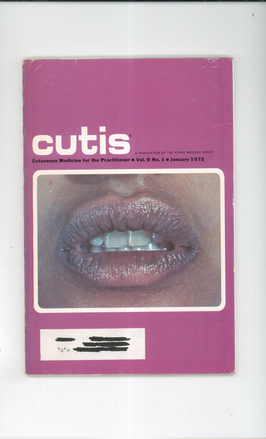 January 1972 Cutis Cutaneous Medicine For The Practitioner Magazine Vintage