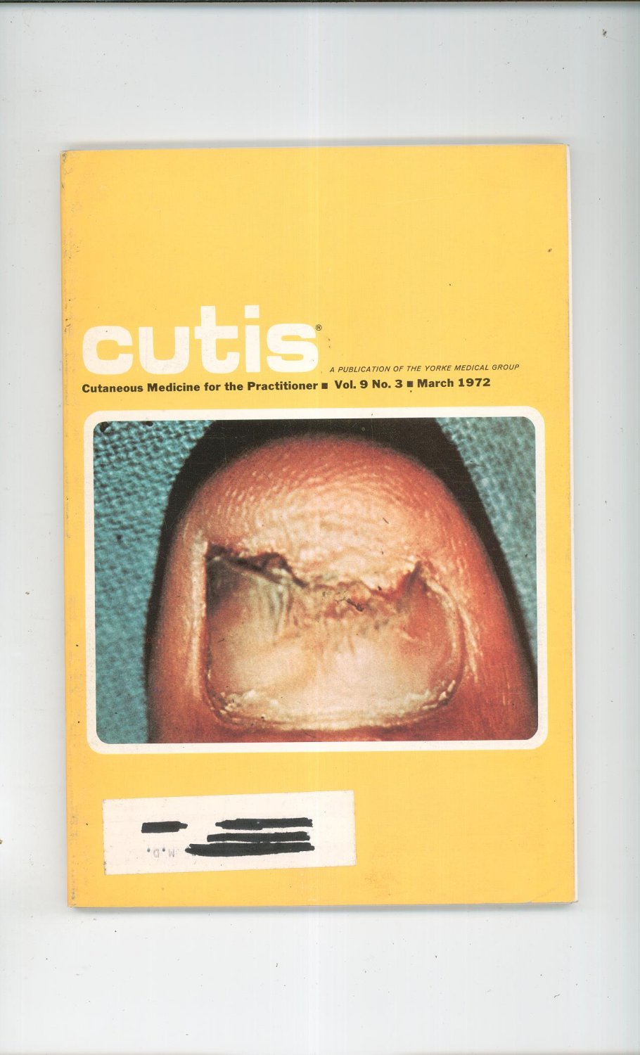 March 1972 Cutis Cutaneous Medicine For The Practitioner Magazine Vintage