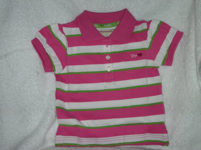 Puff sleeve stripe/multi stri/18-24 M