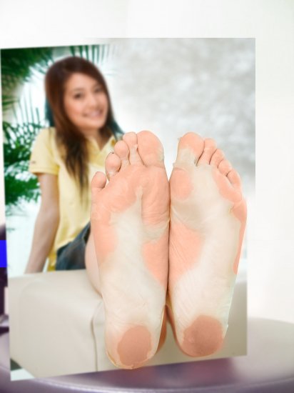 Milky Foot