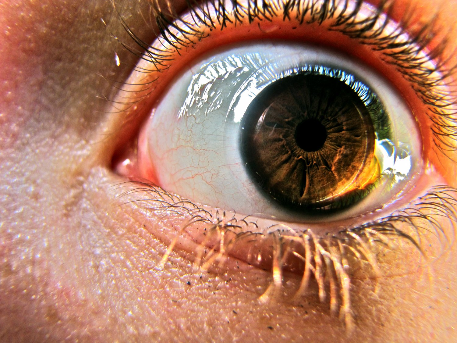 Eye