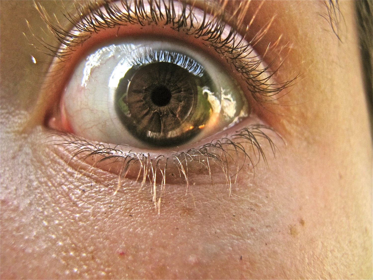 Eye 2