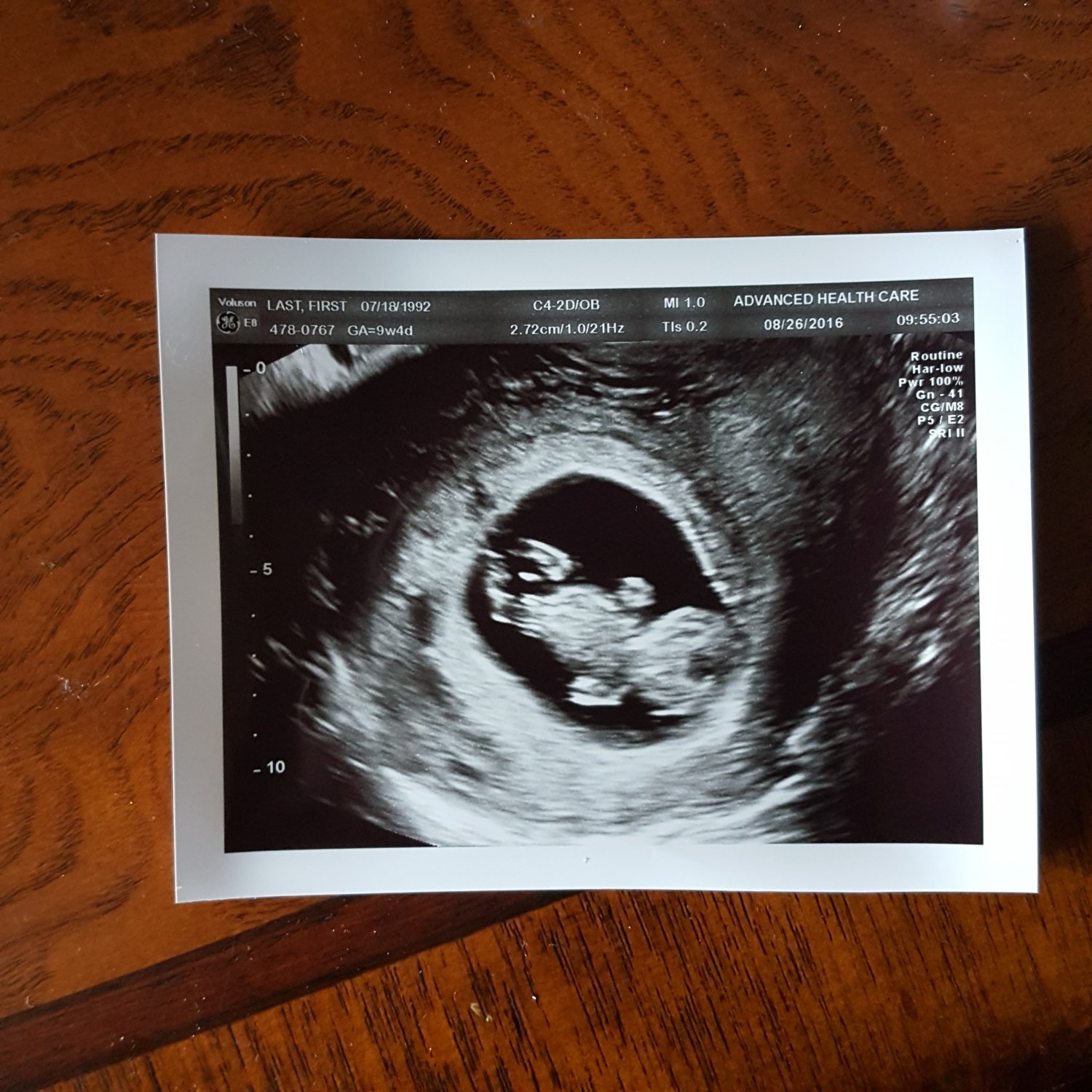 Снимок УЗИ беременности 7 месяцев