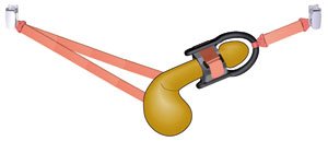 trinitim penis enlargement