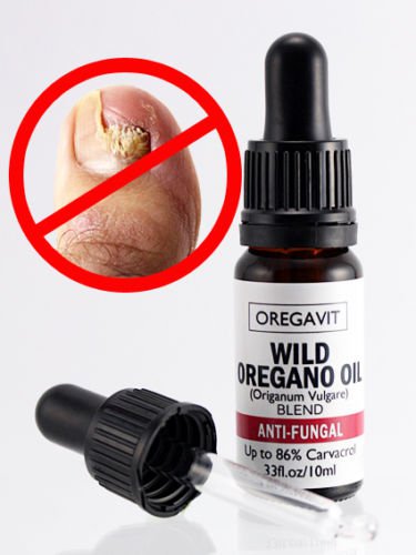 ANTI-FUNGAL MAXIMUM STRENGTH TOENAIL FUNGUS ATHLETES FOOT FUNGI NAIL TREATMENT