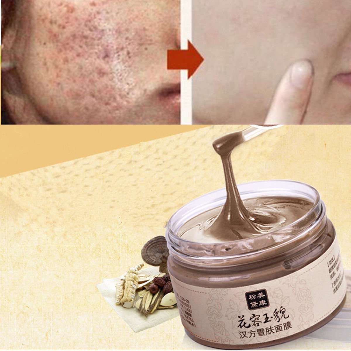 Facial Mask Acne Scars Freckle Remover Face Care Treatment Blackhead Cleansing