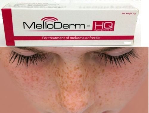 Melloderm Cream Melasma