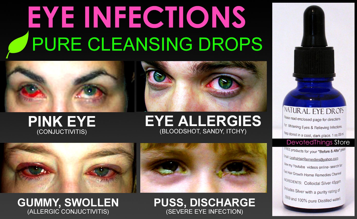 Eye Drops For Eye Infection Over The Counter