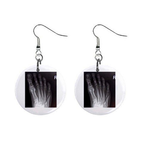 XRAY of a Right Foot Dangle Earrings Jewelry 1 inch Buttons 12306001