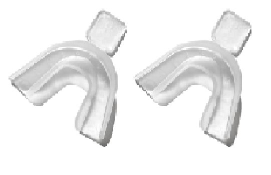Thermo-Molding Custom Fitting Whitening Trays