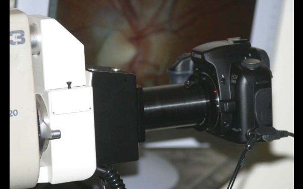 Topcon NW3/5 digital upgrade system
