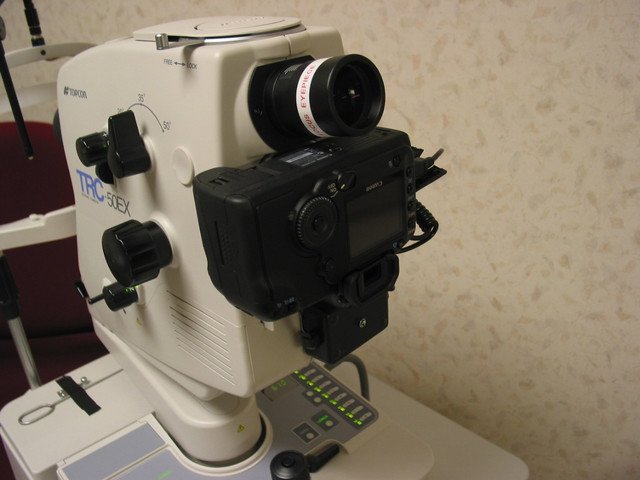 Topcon EX myd retinal camera (FA)