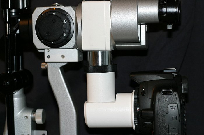 Slit lamp digital upgrade package