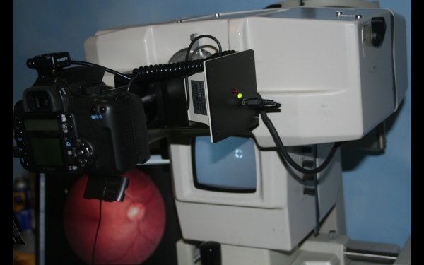 Topcon NW2 upgrade adapter system