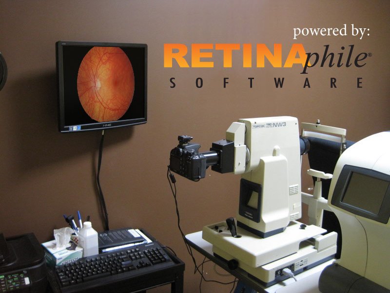 pre-owned Topcon NW3 non-myd camera