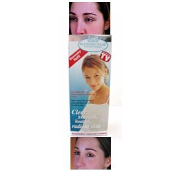 NEW! Wholesale IGIA Blemish Acne Skin Treatment