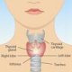 Hyperthyroidism/ Hypothyroidism