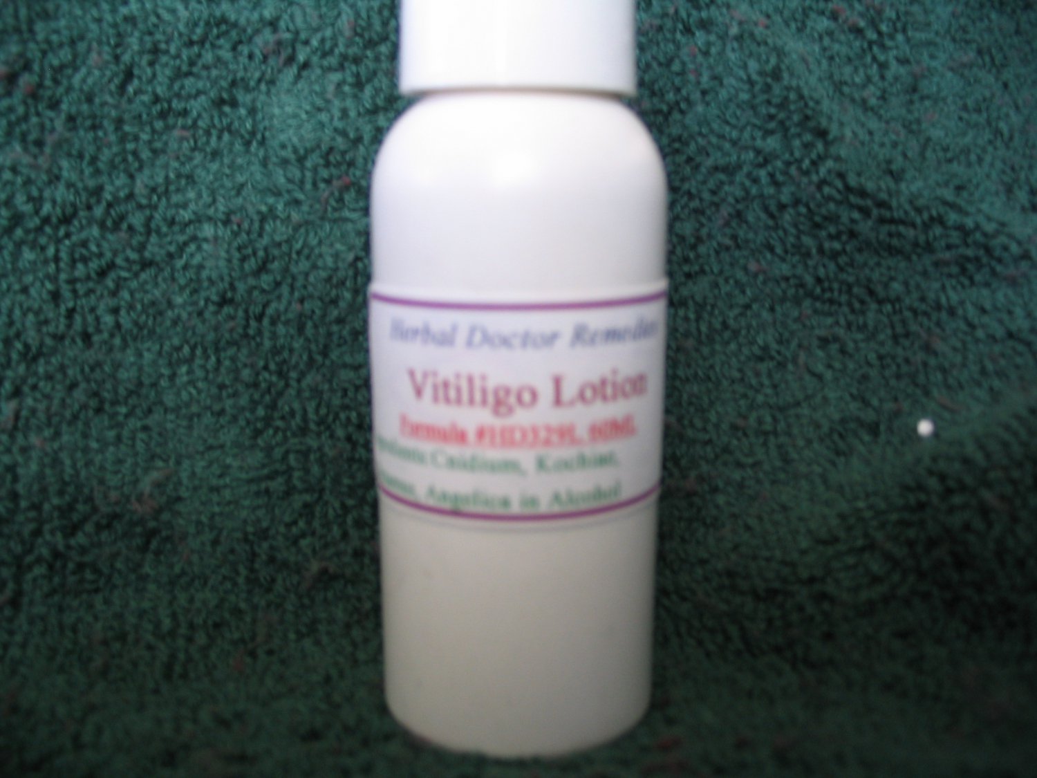 Vitiligo Lotion # HD329L