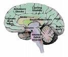 Train your brain for weight loss CD