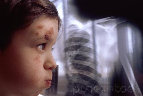 Child Abuse - A Global View - SRI Lanka