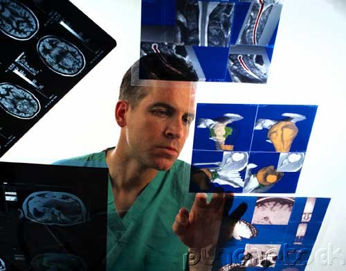 Fetal Alcohol Syndrome - Surveillance Of Fetal Alcohol Syndrome