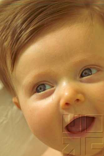 Child With Alterations In Genitourinary Function III