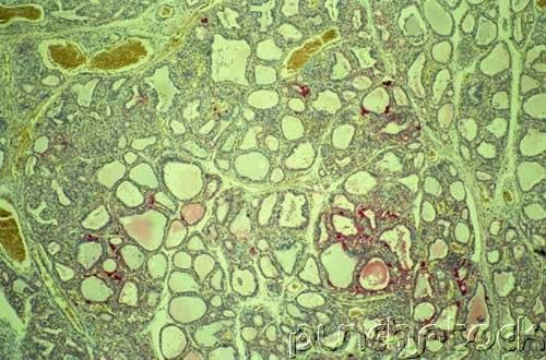 How Animals Survive - The Immune System & The Body's Defenses