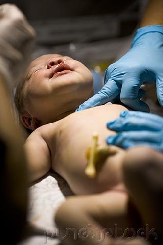 Analyzing Malpractice In The Hospital Setting - Nursing Malpractice In The Delivery Room