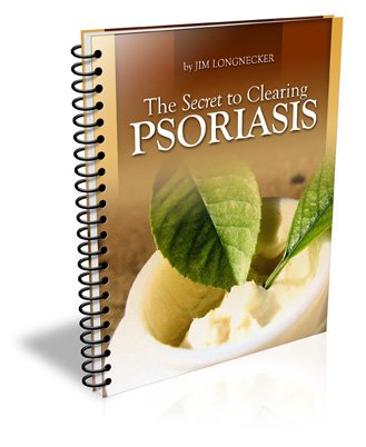 The Secret to Clearing Psoriasis