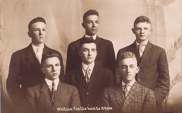 Waiting For The Hair To Grow, Real Photo Post Card RPPC - 3620