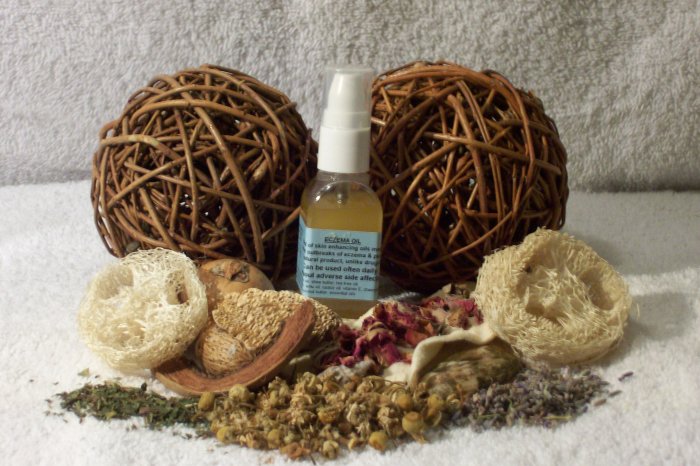 ECZEMA/PSORIASIS TOPICAL OIL-11 moisturizers, african essential oils, NO steroids