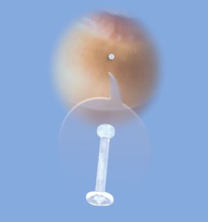 Labret Retainer (VLT-3)