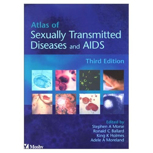 Atlas of Sexually Transmitted Diseases and AIDS