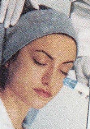 Microdermabrasion
