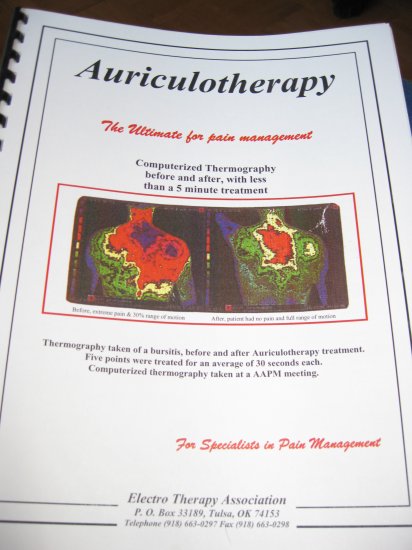 Auriculotherapy