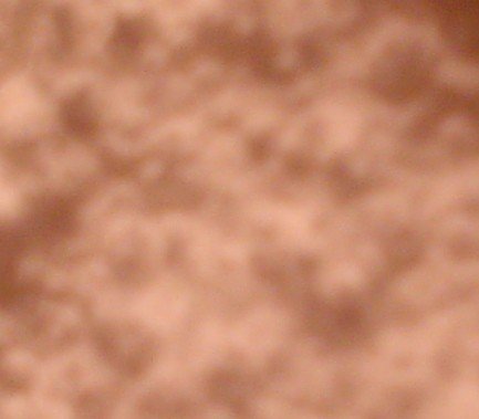 Allantoin