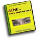 Acne - How to Treat It and Beat It