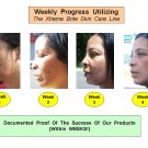 Facial View Documentation Of Product Use