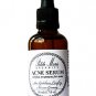 Acne Serum Oil-Free Topical Treament for Adult Acne 50 ml 1.7 oz