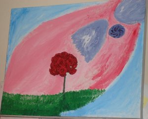 Rosey Vision