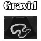 Gravid T-Shirt